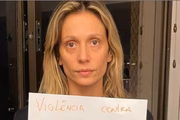 Luisa Mell ganhou destaque na mídia ao defender os direitos dos animais 