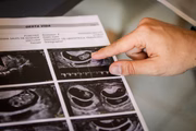 Eles realizaram fertilização in vitro