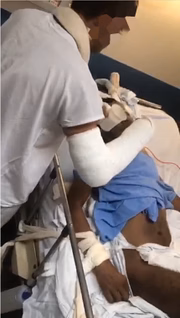 Rapaz com os dois braços engessados dá comida para senhor amarrado em cama