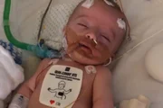 Ele foi colocado em coma induzido depois de sofrer uma parada cardíaca