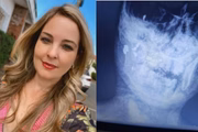 Corpo da dentista Bruna Viviane Angleri, 40 anos, foi encontrado carbonizado em cima da cama