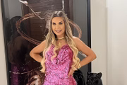 Deolane também investiu na harmonização facial, procedimento famoso entre celebridades