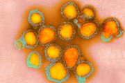O termo flurona é a junção das palavras “flu” (gripe, em inglês) e “corona” (de coronavírus). A coinfecção é identificada quando o teste para os dois vírus apresenta resultado positivo 