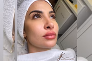 A ex-BBB, influenciadora e empresária se submeteu a uma harmonização facial 