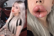"Quase morri", relatou Kristina Vishnivetskaya