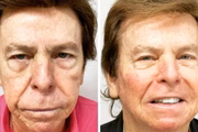 Veja o antes e o depois
