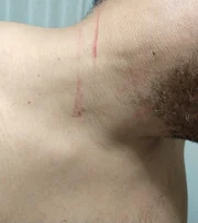 Ele diz que foi arranhado pela mulher