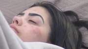 Mirella chegou a ter uma reação alérgica por conta de estresse no reality