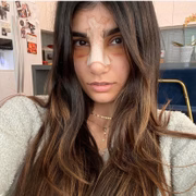 Recentemente, a bela fez uma rinoplastia