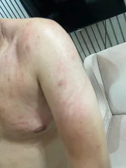 DJ Ivis com marcas de agressão