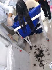 O ácido sulfúrico causou queimaduras em todo o corpo da garota, inclusive no couro cabeludo 