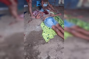 Vítima de tentativa de feminicídio no chão de casa, após levar pauladas na cabeça com cabo de vassoura