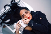Modelo brasiliense Larissa Sampaio também tem vitiligo 