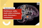 Parkinson é uma doença neurológica caracterizada pela degeneração progressiva dos neurônios responsáveis pela produção de dopamina