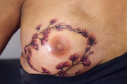 Só se pode fazer a tatuagem no seio depois um ano da cicatriz feita. A artista informou que, depois de feita a reconstrução e todas as cirurgias, é preciso esperar um ano para poder fazer