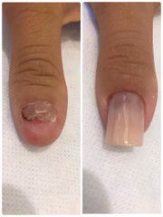 É uma ótima alternativa para quem tem o hábito de roer unhas
