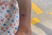 A dona dos cães também foi atacada pelo cachorro agressivo 