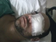 Fotógrafo Sérgio Silva após cirurgia