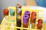O exame deve ser realizado a partir do 10º dia de sintomas. A precisão do resultado é menor do que nos testes do tipo RT-PCR. Além disso, falsos negativos podem aparecer com mais frequência