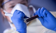 Anvisa já havia alterado prazo de validade