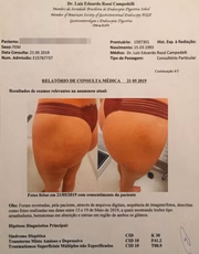 Laudo médico foi feito dias depois do encontro com o craque da Seleção Brasileira