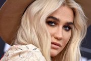 A cantora estadunidense Kesha é conhecida pelo rosto marcado com sardas