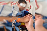 Criança no hospital após acidente 