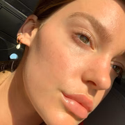 Agora, a acne deu uma trégua, e a rosácea está sob controle