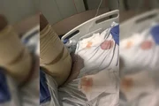Modelo denunciou atendimento precário no pós-operatório e afirma que clamava por atendimento, mas não havia nenhum integrante da equipe do cirurgião no hospital para ajudá-la