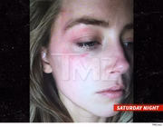 Uma das fotos incluídas por Amber no processo contra Johnny Depp