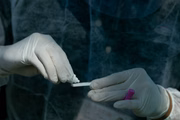 Já o teste sorológico identifica anticorpos no sangue