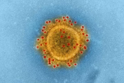 Cerca de 73% dos pacientes que tiveram Covid-19 apresentam sintomas nos meses seguintes à infecção, segundo a Universidade de Stanford, nos Estados Unidos 