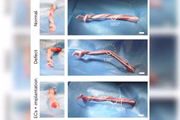 Duas semanas após a implantação, o modelo implantado permitiu a recuperação de um formato normal de pênis em porcos com defeitos do corpo cavernoso durante a ereção. Círculos laranja indicam os locais de defeitos criados cirurgicamente.