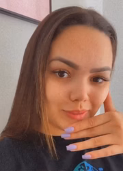 Ela também colocou botox na testa