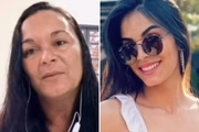 Jovem atacada com soda cáustica teve queimaduras dentro da boca