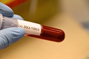 Os sintomas da zika são iguais aos da dengue, só que a infecção não costuma ser tão severa e passa mais rápido. Há, no entanto, um complicador caso a pessoa infectada esteja grávida