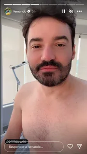 Fernando Zor passa por procedimento para aumentar o bumbum (Reprodução: Instagram)