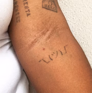 Nick tatuou emoji que usa com frequência no braço esquerdo