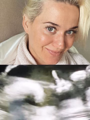Katy Perry ficou impressionada ao ver a ultrassom da primeira filha 