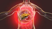 Já na hepatite B, o fígado pode apresentar um quadro de inflamação persistente e há risco de a doença evoluir para cirrose hepática. Ela pode ser identificada através de exames laboratoriais. Na maioria dos casos, pode ser tratada com medicamentos antivirais que impedem a multiplicação do vírus e retardam ou melhoram a evolução da doença