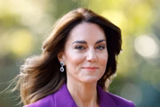 A princesa de Gales não perdeu o cabelo ao longo do tratamento de câncer