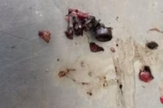 Médico legista retirou fragmentos de bala do rosto de dentista carbonizada