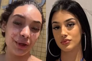 "Me pisoteou o chão", afirma mulher envolvida em briga com Bia Miranda