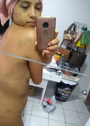 Espancada, a vítima apresentava vários hematomas por todo o corpo