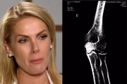 Ana Hickmann acusa o marido de agredi-la em casa, em Itu, no interior paulista