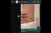 Lucas Bove manda foto para Cíntia Chagas mostrando marca de suposta cotovelada