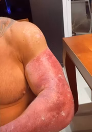 Na quarta (29/9), Leo mostrou como anda a recuperação dos ferimentos