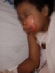 A vítima foi internada no Hospital Regional da Asa Norte (Hran)