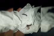 Ele foi encaminhado ao HRG, onde recebeu o soro contra a mordida