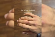 Nahuel Medina publicou uma postagem em suas redes sociais após o soco contra Duda Faria 